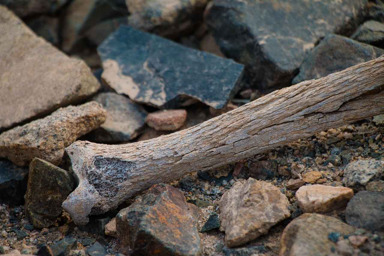 Kemiği Güçlendiren İmplantlar: Osteoporoz Hastaları İçin Yenilikler